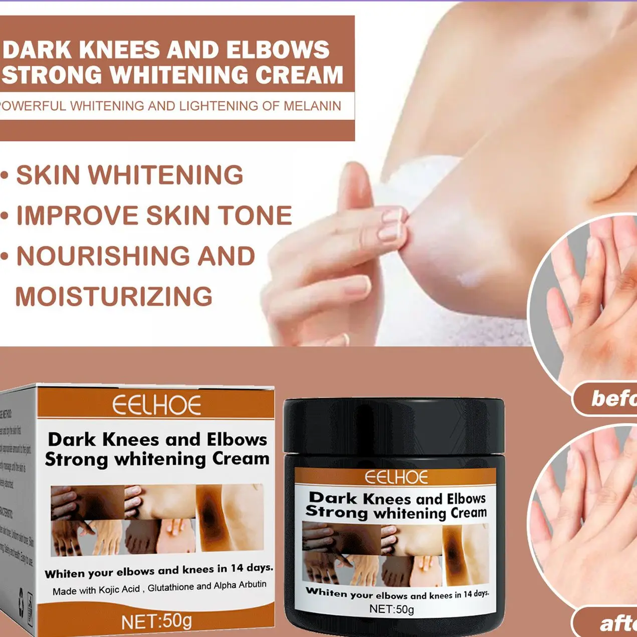 Joint Whitening Cream  50g To Lighten Dark Bright And White Skin Joint Elbow Whitening And Moisturizing Repair Cream