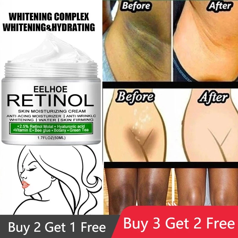 

Body Whitening Cream Underarm Knee Buttocks Private Bleach Remove Melanin Pigmentation Improve Dull Nourish Brighten Skin Care