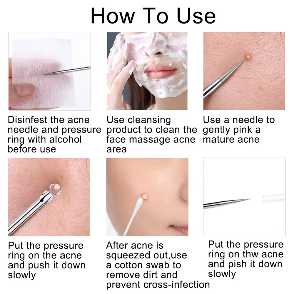 4 шт. иглы для удаления чёрных точек на лице |