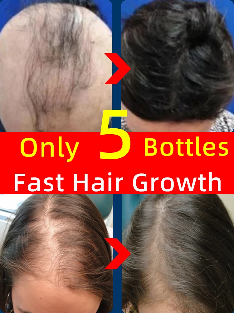 

Hair Growth Products Oil For Fast Anti Loss