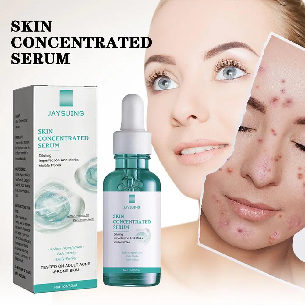 

Pure Vitamin C10 Serum 30ml Anti-Wrinkle Antioxidant Essence Hyaluronic Acid Brightening For Aging Skin Care N4X5