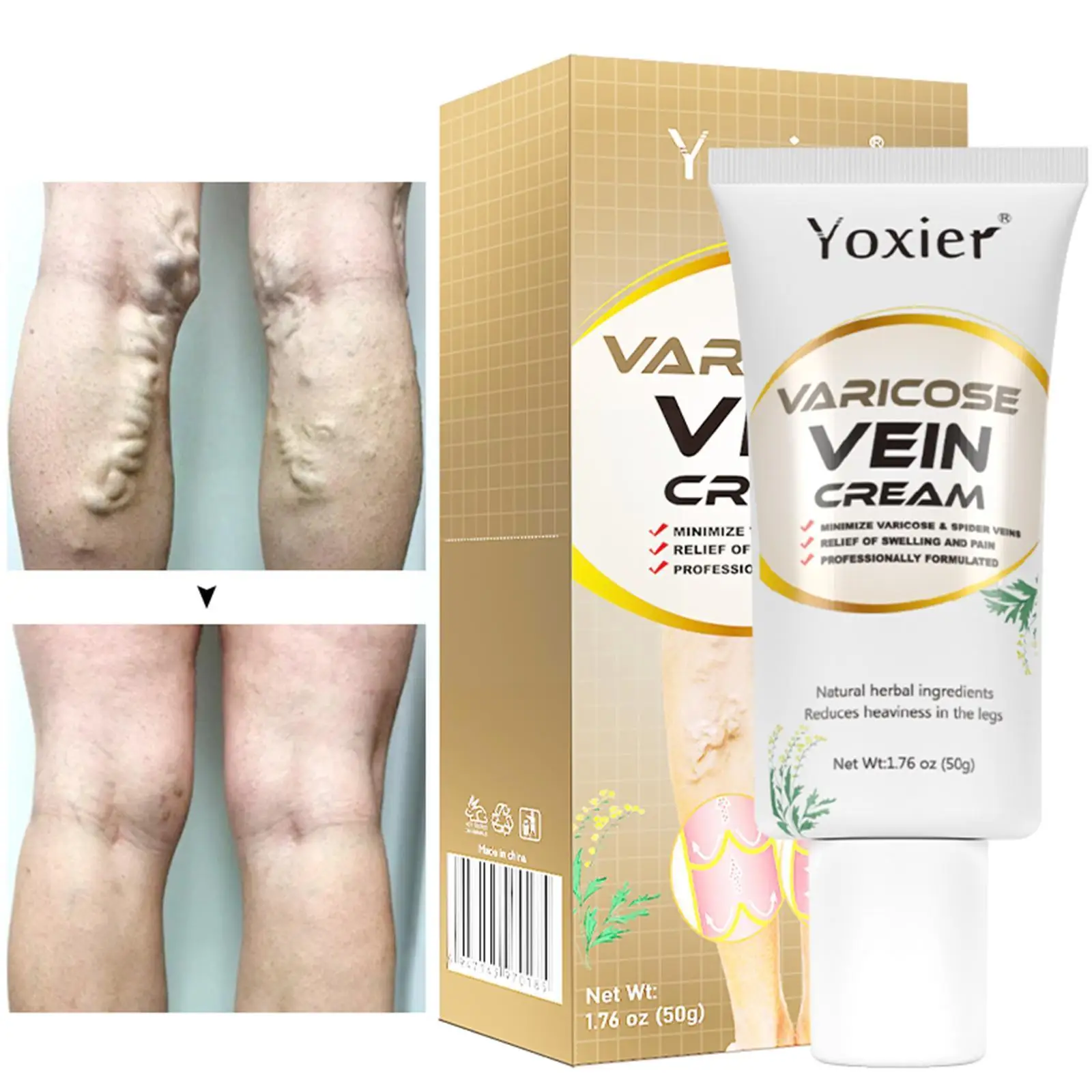 

50g Varicose Vein Cream Promotes Blood Circulation Care Herbal Spider Body Vein Treatment Veins Phlebitis Legs Varicose Cre Z0O3