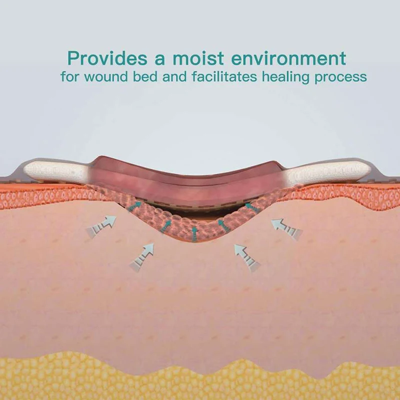 5 шт. абсорбирующие подушечки для ран 10 х1 0/2 х30 см
