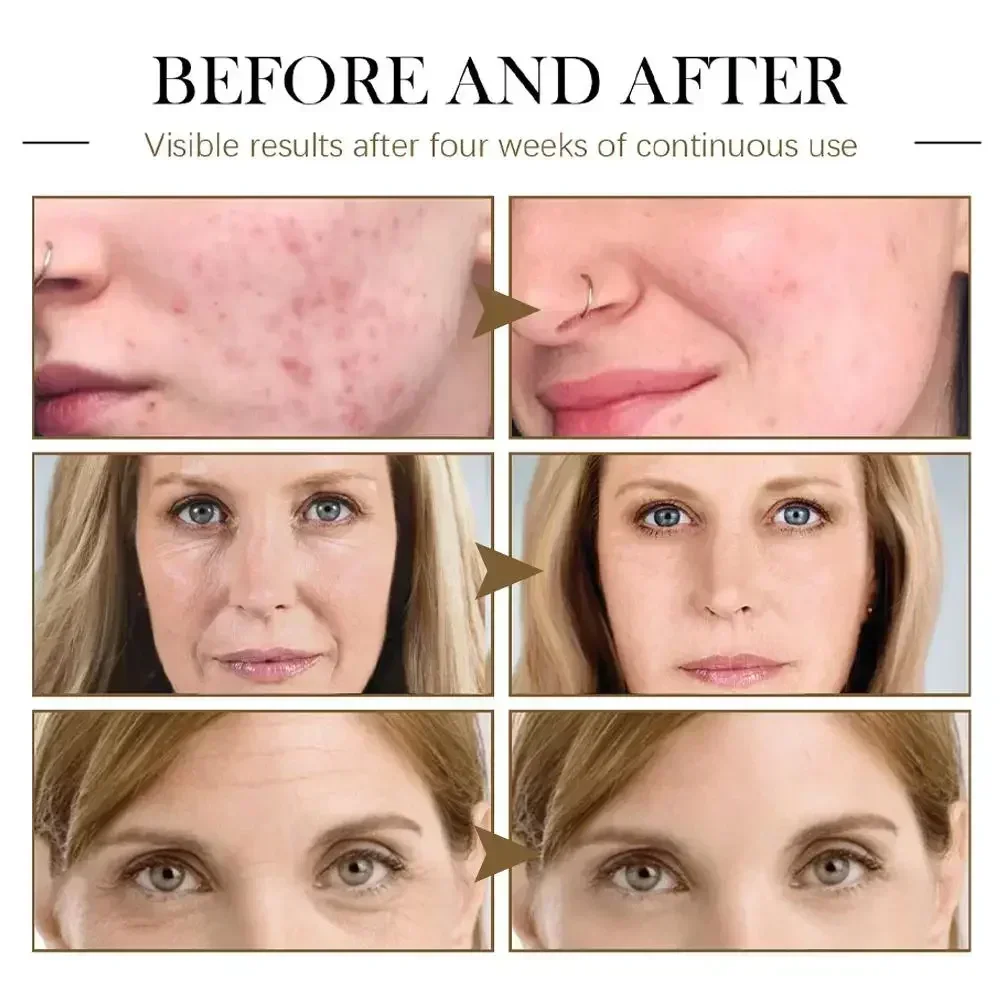 Przeciwstarzeniowy olejek eteryczny do masażu Kolagen Boost Moisturiser Kobiety i mężczyźni Pielęgnacja twarzy Naturalny z dzikiej róży Serum