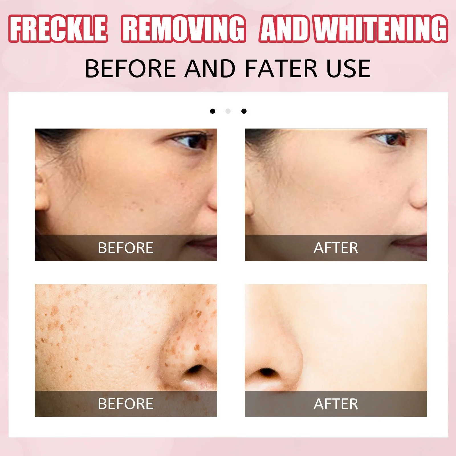 3 дня увлажняющая искусственная кожа осветляющая кожу