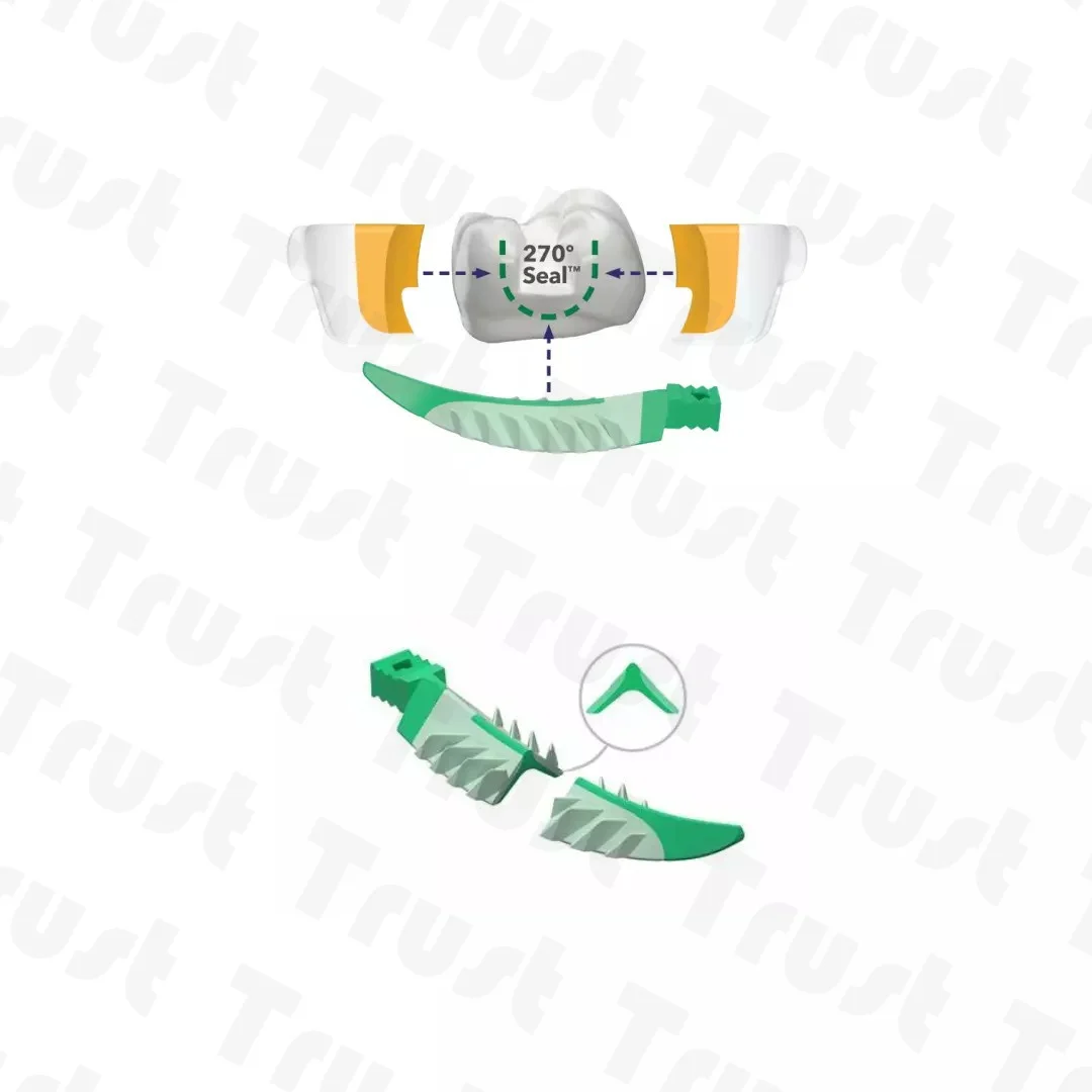 Стоматологические эндострационные клинья мягкое шейное уплотнение диастема