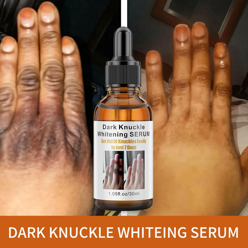 

30 ml Finger joint black removing and skin brightening essence elbow and knee whitening essence