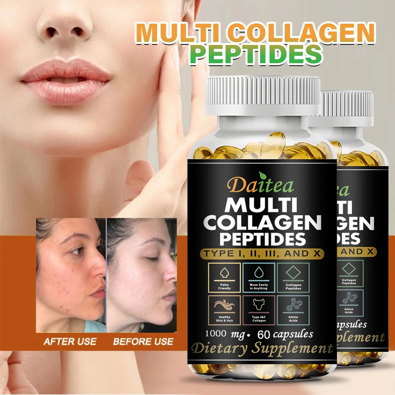 

Collagen Supplement - Helps Skin Whitening, Hydration, Wrinkle Reduction, Anti-aging and Antioxidant, Promotes Joint Health.