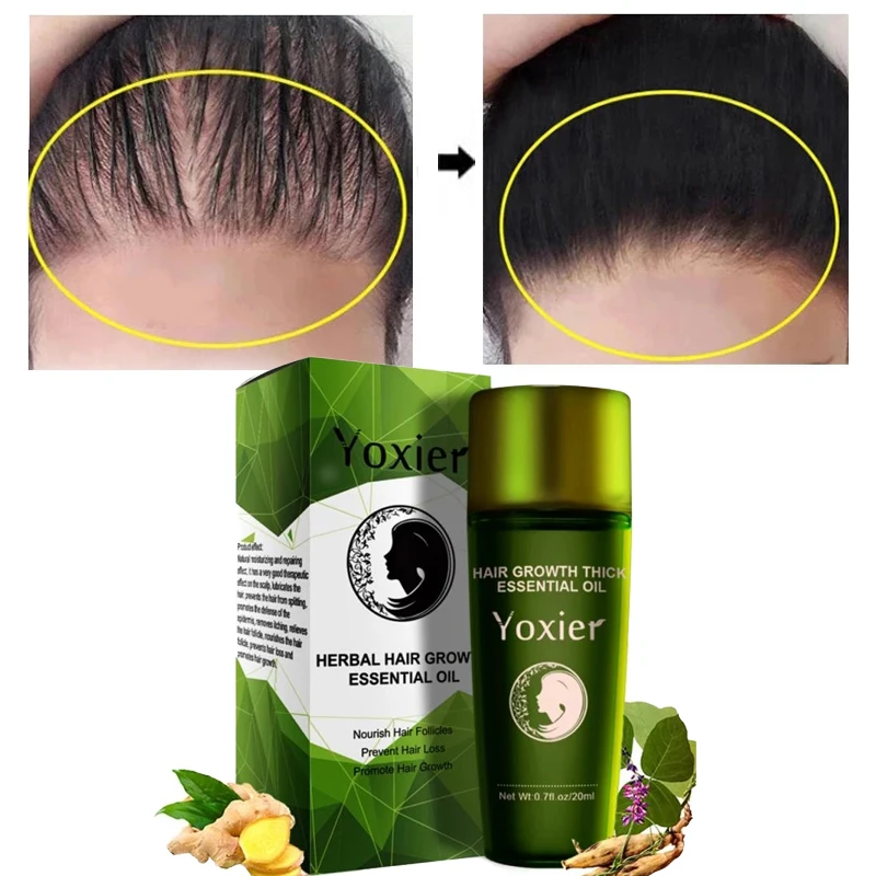 20ml Herbal Hair Growth Essential Oil Hair Care Styling Thick Fast Repair Growth Treatment Fluid Anti-Hair Loss TSLM1
