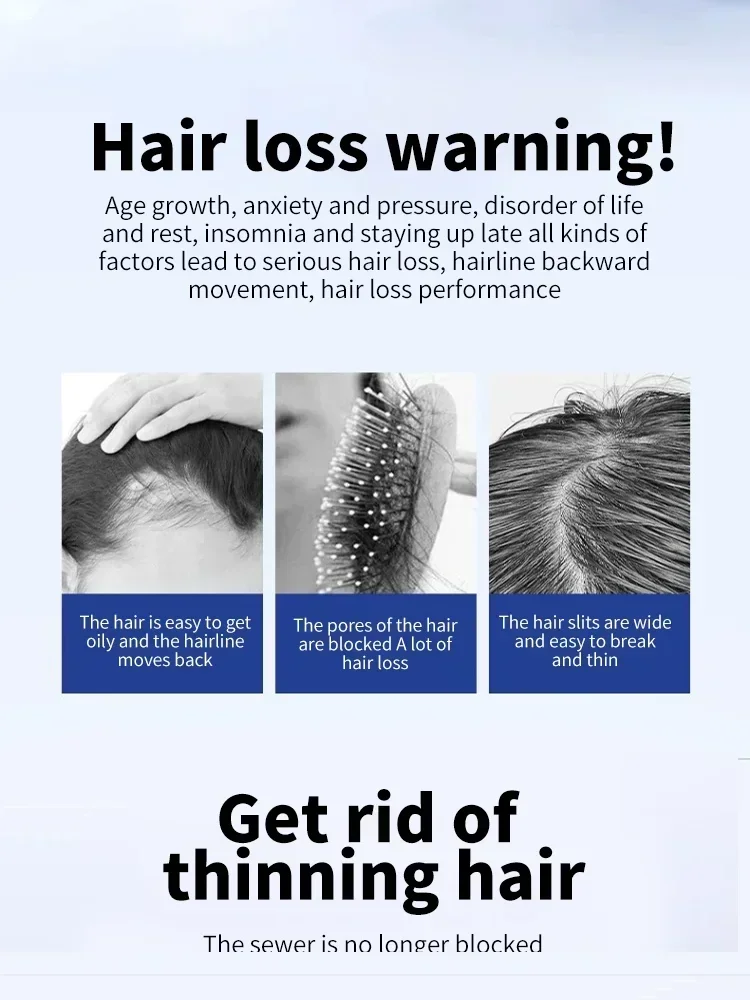 Рост волос для мужчин и женщин имбирное натуральное масло роста уход за волосами