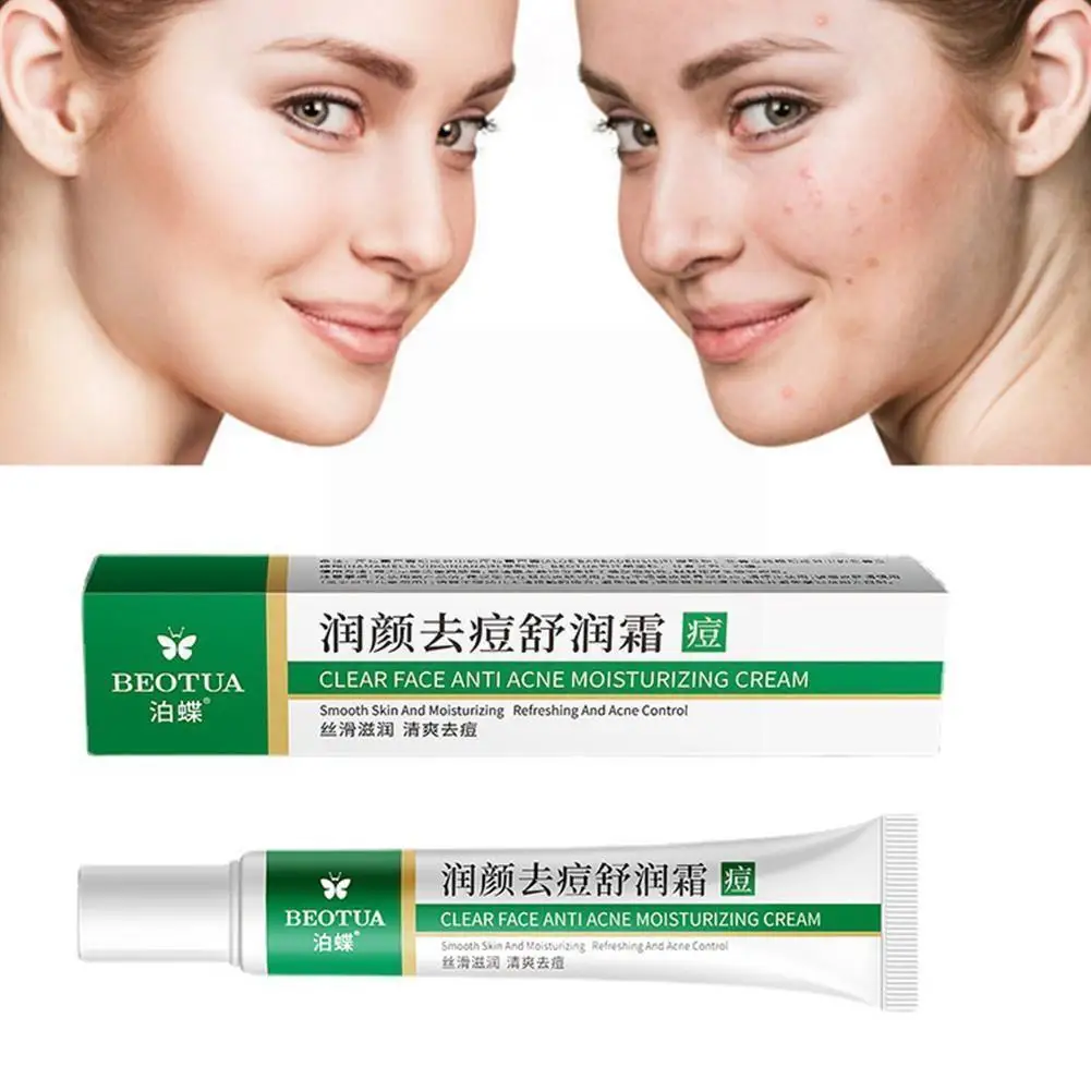 

20g Effective Acne Removal Cream Herbal Acne Spots Face Care Gel Oil Control Moisturizing Acne Skin Cream Whitening Skin Ca F2k4