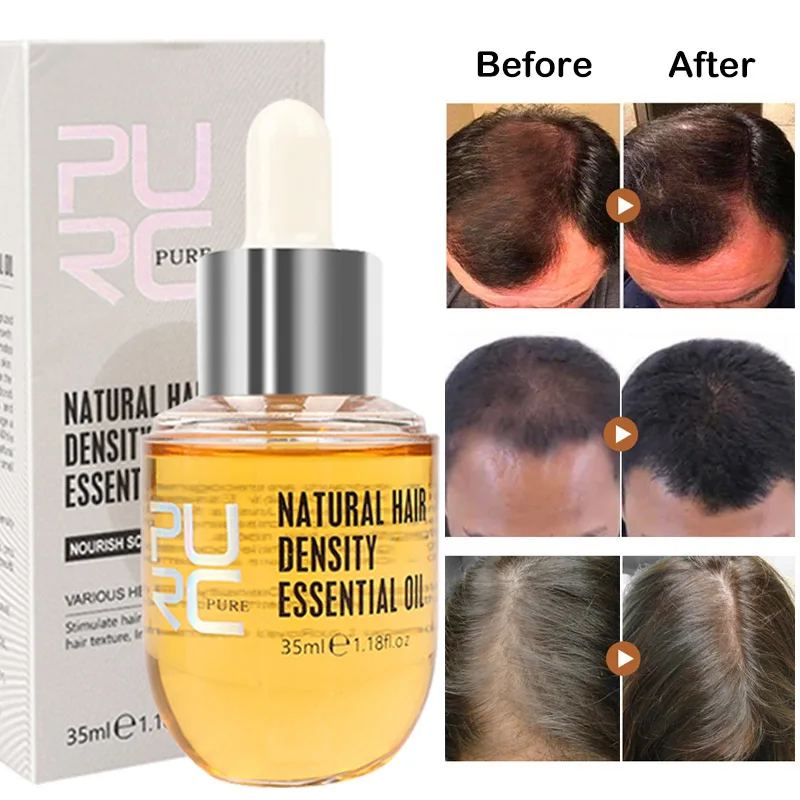 

35ml Ginger Essence Hair Growth Products Fast Regrowth Hair Loss Care Enhancer Scalp Treatment Essential Oil for Women Men