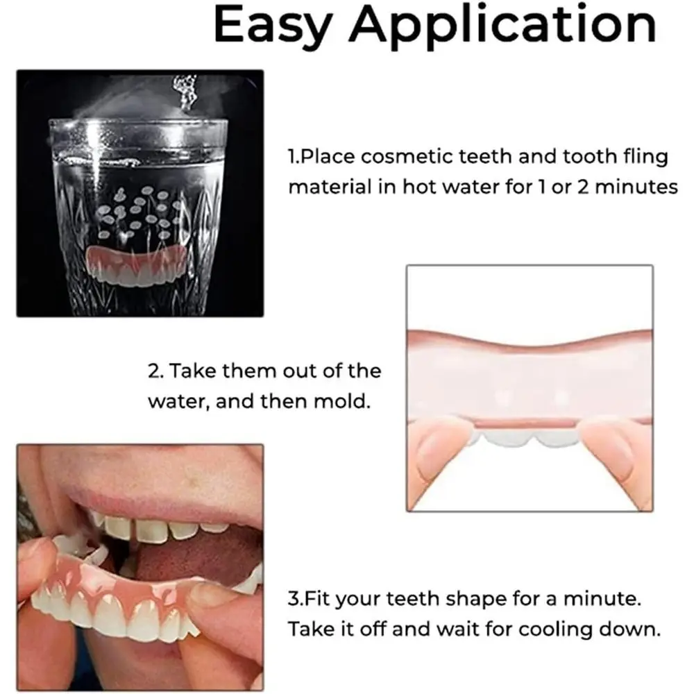 Фото Набор для силиконовой подкладки зубных протезов Soft Fix Your Smile: мгновенная фиксация за минуты №2