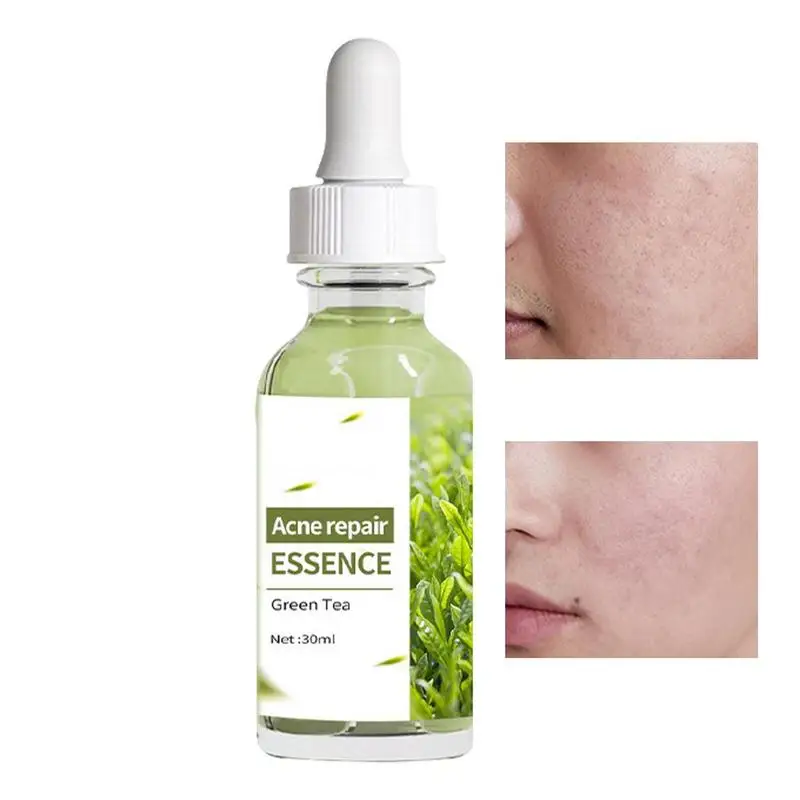 

Pimple Spot Serums Green Tea Shrink Skin Pores Face Essence 30ml Skin Pimple Repair Moisturizer Shrink Face Pores Repair Essence