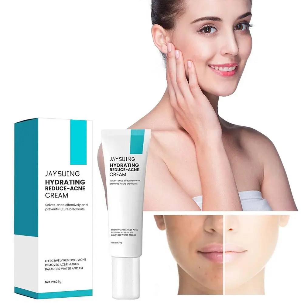 

Hydrating Face Acne Cream Moisturizing Control Oil Removal Remove Pores Marks Pimple Shrinking Product T1G0