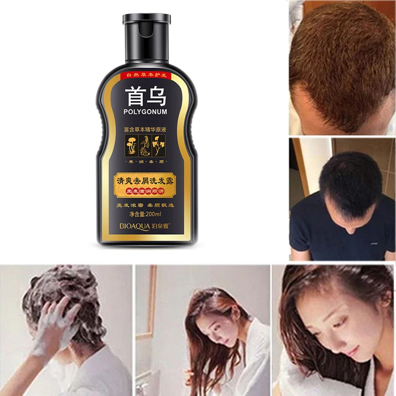 

BIOAQUA Polygonum Multiflorum Anti-dandruff Shampoo Nourishing Ufa Chinese Herbal Hair Growth Repair Damaged Rough Dry Hair