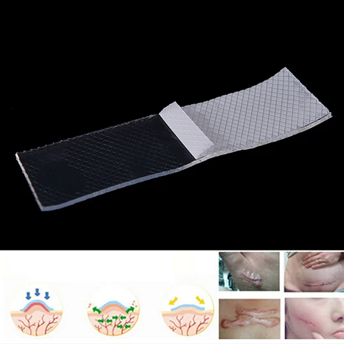 

Efficient Surgery Scar Removal Silicone Gel Sheet Therapy Patch for Acne Trauma Burn Scar Skin Repair Scar Treatment 3*12cm