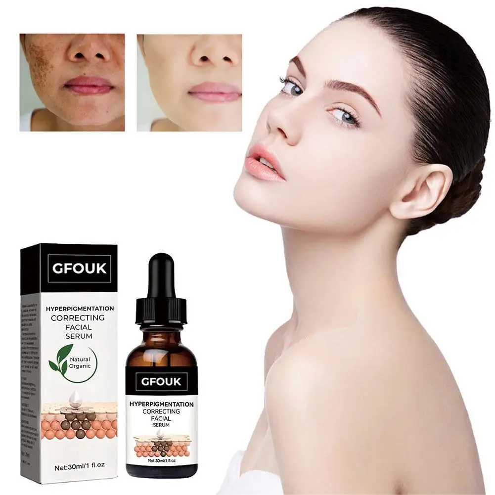 

30ml Vitamin C Whitening Freckle Face Serum Repair Dark Spots Essence Fade Melasma Remove Pigment Moisturizing Skin Care