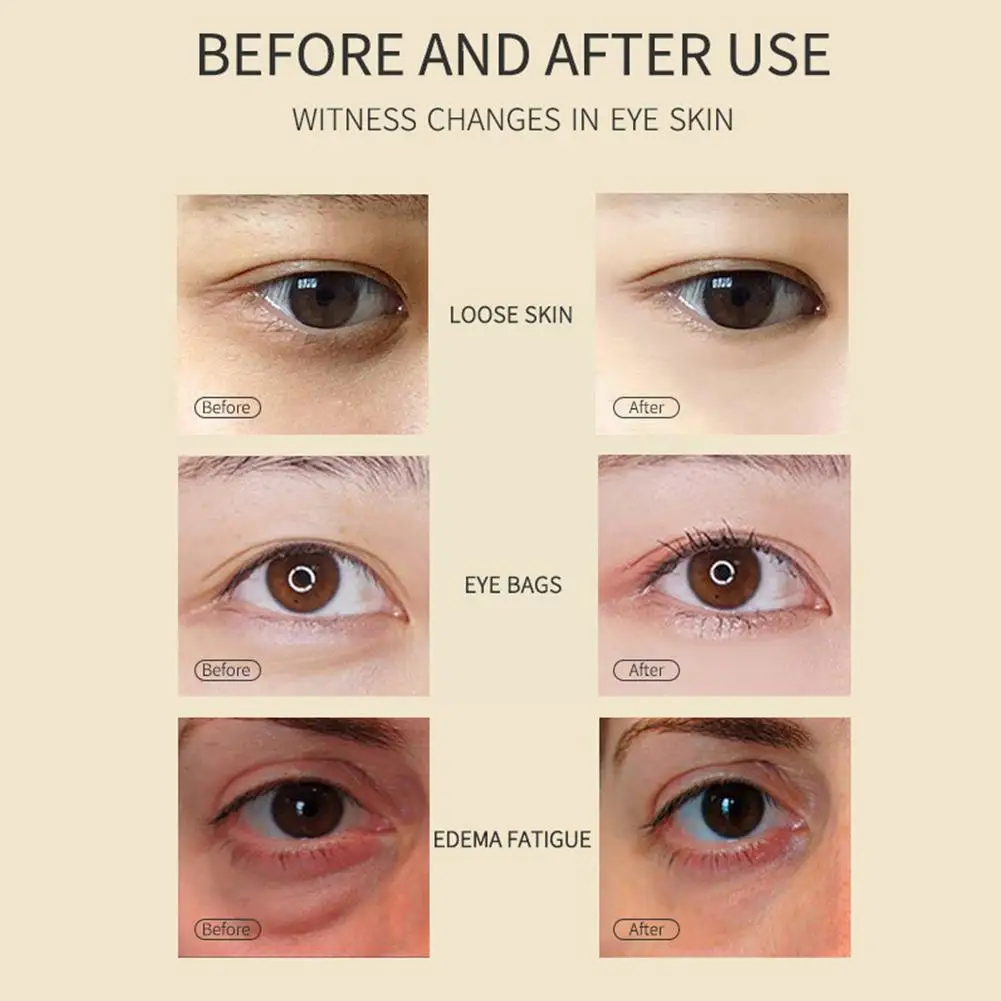 

Hyaluronic For Eye Care Crystal Female Eye Patches Anti Wrinkle Anti-aging Gel Eye Dark Circle Remove Eye Bag R7b5