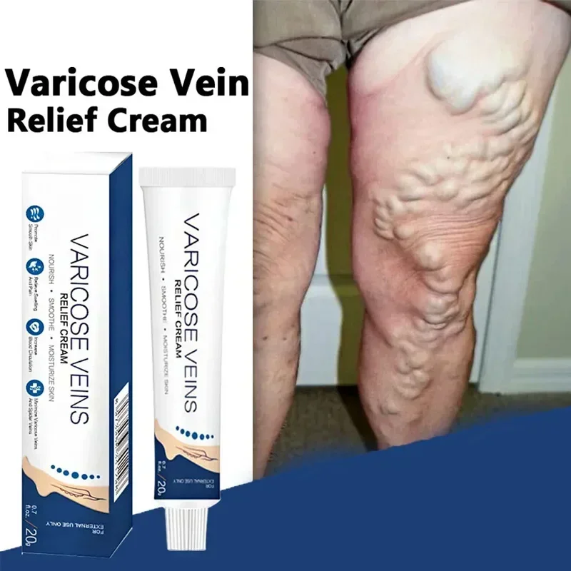 Крем от варикозного расширения вен Earthworm-Успокаивающий массажный бальзам для