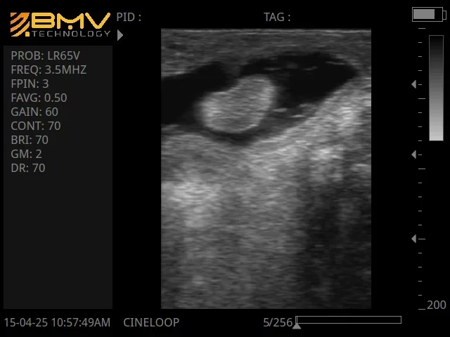 Ультразвук для использования в Fram ветеринарный Ультразвуковой Анализатор Bmv L60