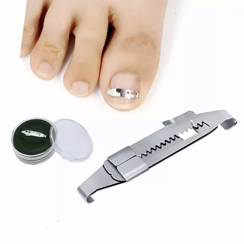 

Toe Nail Correction Wire Fixer Pedicure Paronychia Recover Toenails Corrector Foot Care Tool High Quality