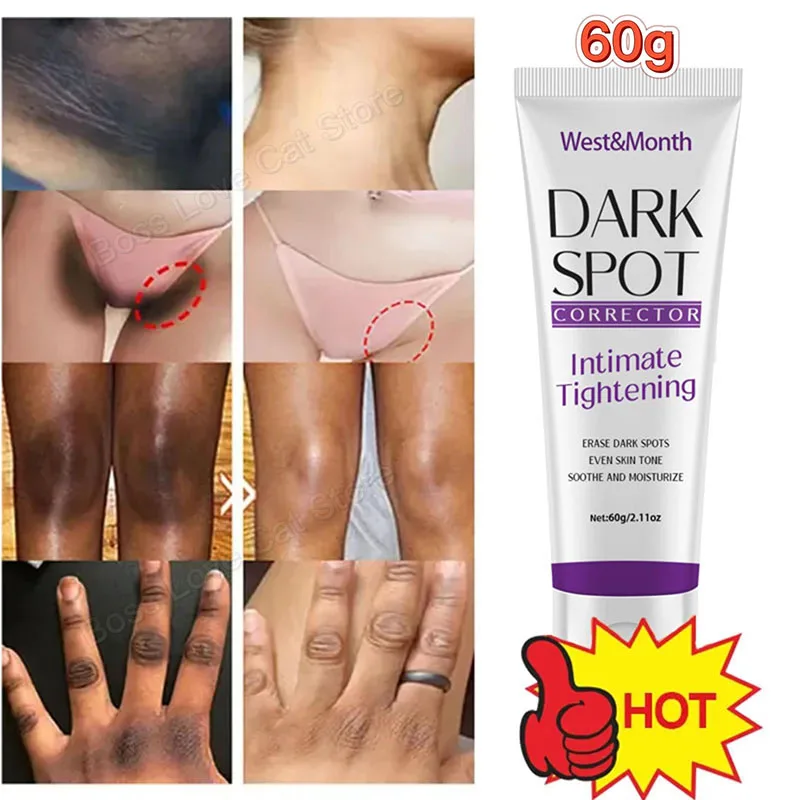 

Quickly Private Parts Whitening Cream Dark Skin Underarm Brightening Cream Inner Thighs Elbows Bleach Joint Remove Melanin Cream