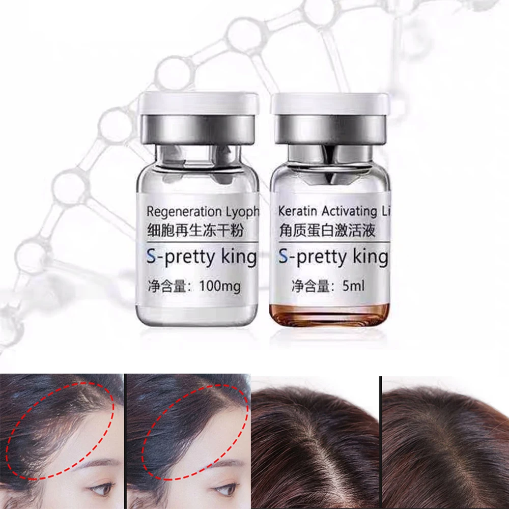 

28 Days Fast Grow Prevent Thinning Hair Care Essence Stem Cell Hair Growth Serum Anti Hair Loss 2pcs/Set