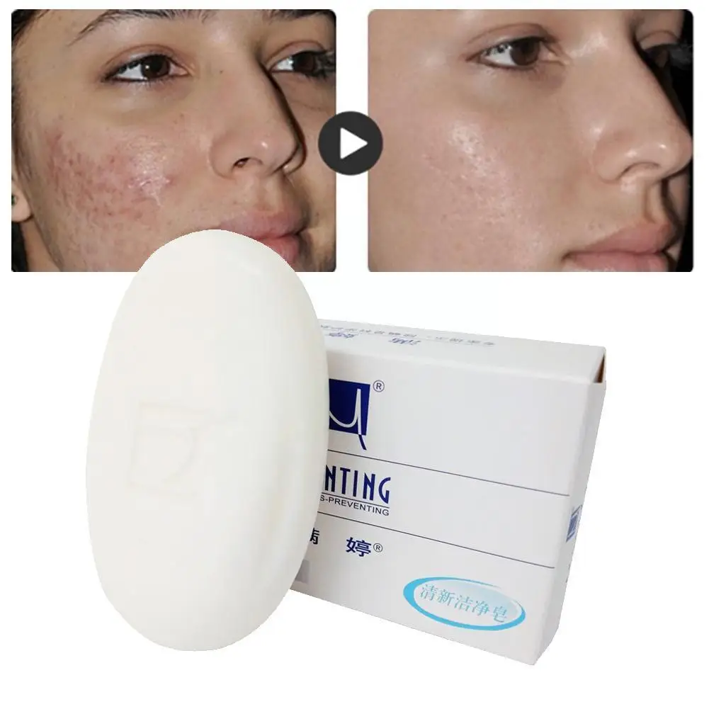 

Manting Mites Acarus Soap Acari Bacteria Removing Body Soap Oil Clean Handmade Face Control Care Acne Skin Soap Herba