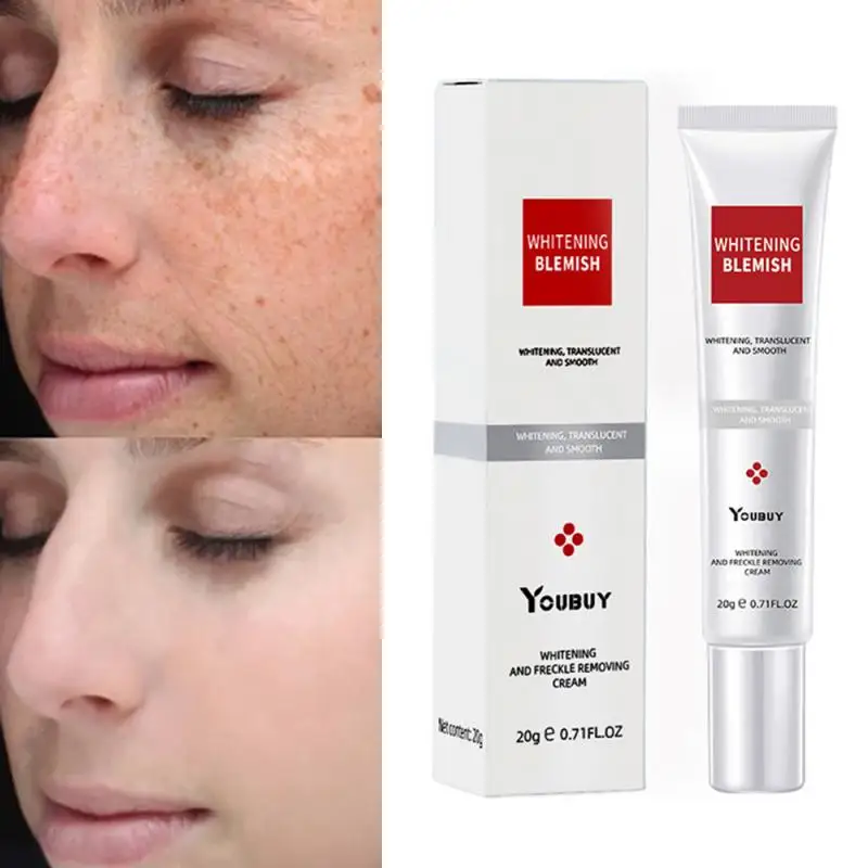 

Whitening Freckle Face Cream Remove Melasma Remove Dark Spots Melanin Moisturize Brighten Face Skin Care Make-up for Women