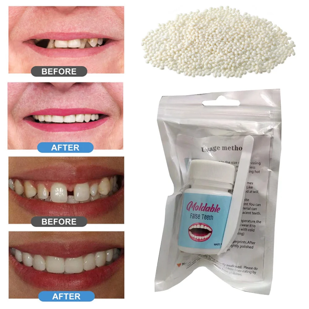 

20g Shapeable Teeth Glue Repair Broken Teeth Tooth Gaps DIY Dental Filling Material Particles Dentures Modification Makeup