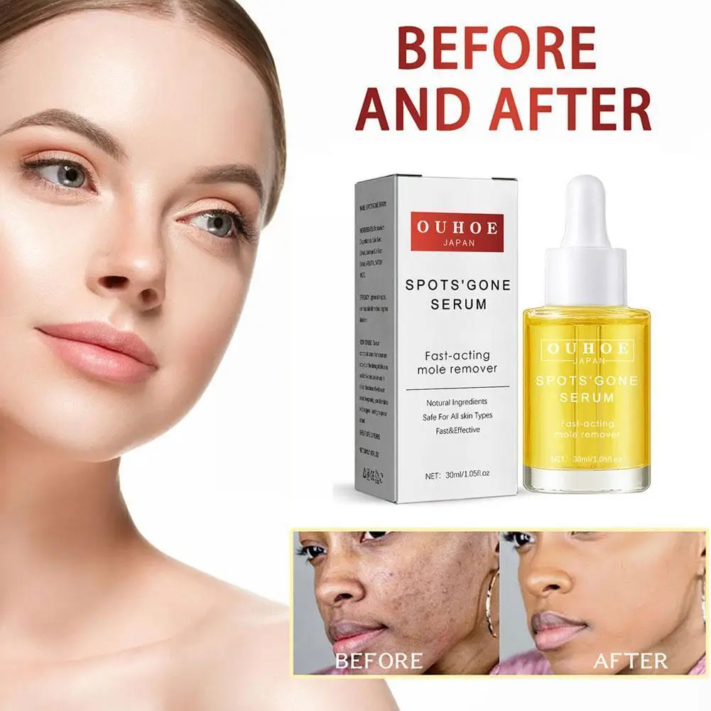 

Уход за кожей лица с витаминами и отбеливающими пятнами, 30 мл