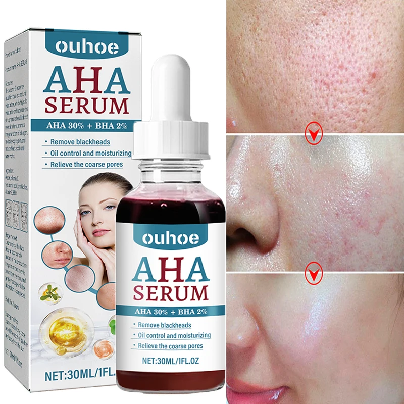 Fruit Acid Pore Shrink Face Serum Remove Blackheads Acne Treatment Moisturizing Essence Oil Control Whitening Smooth Skin Care