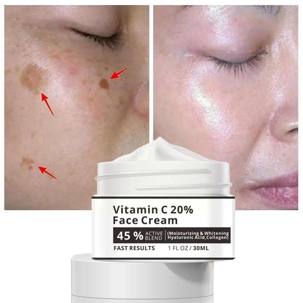 

Vitamin C 20% Face Cream 30ml Remove Dark Spots Moisturizing Cream Care Skin Health Facial Beauty Moisturizer Whitening R1X0