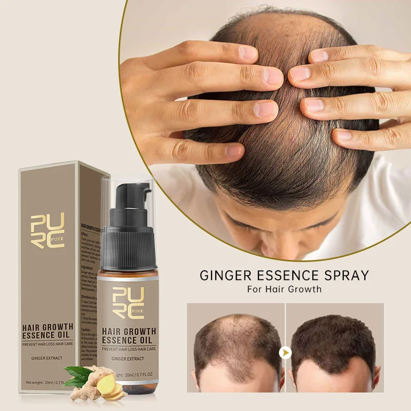 

PURC Ginger Hair Growth Essential Oil Anti Hairs Loss Liquid Baldness Remedy Boost Grow Thicker Scalp Treatment Hair Care 20ml