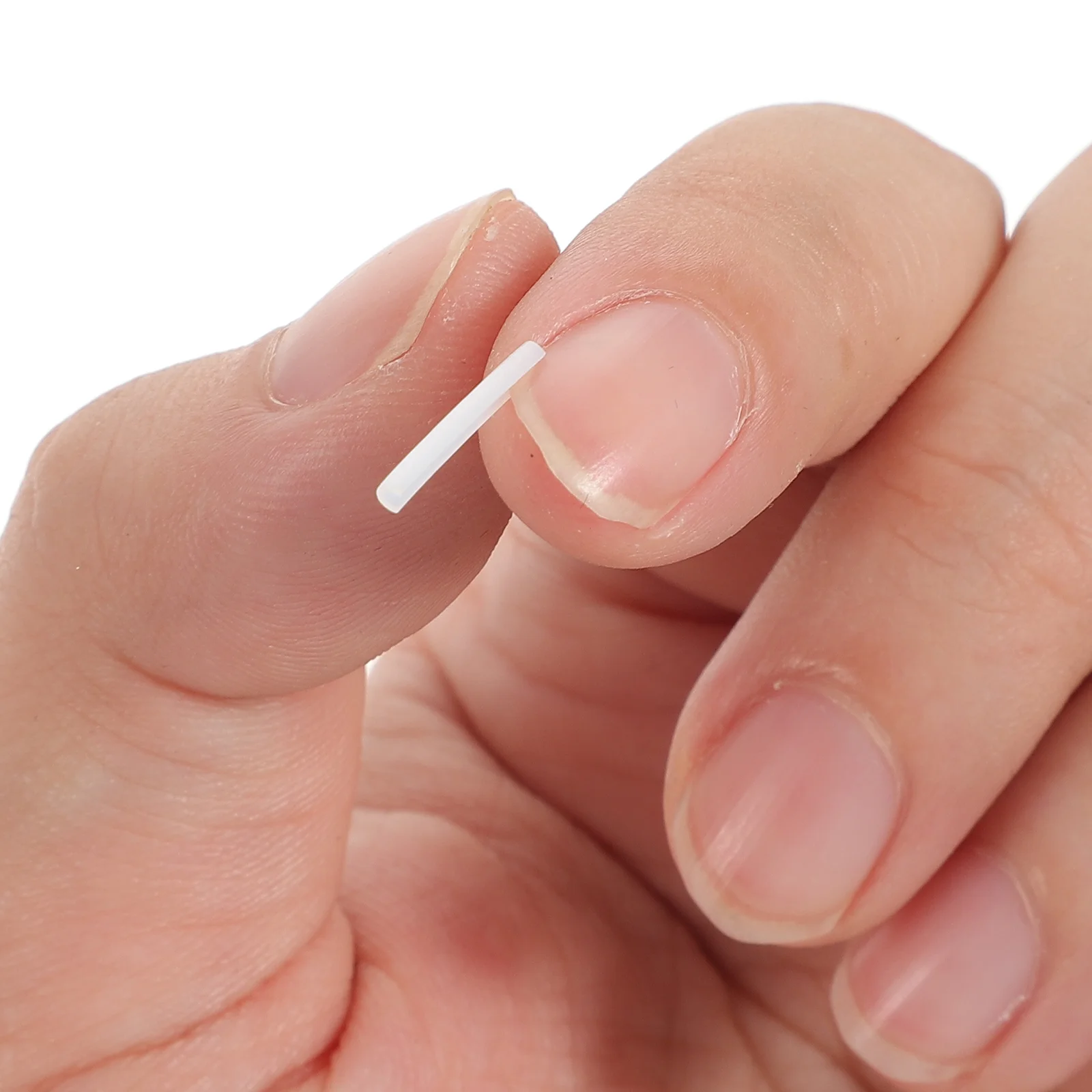 

Toenail Ingrown Nail Tool Corrector Accessory Pedicure Toe Correction Tools Care Correctors Separators Straightener Correct