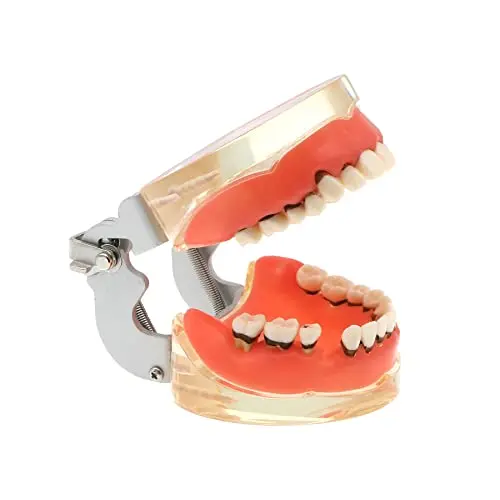 Dental Teeth Typodonts Model for Parodontopathy Periodontal Disease, Removable Gingivae Pathology Teeth Model Used in Teaching