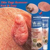 skin tag remover cream painless mole skin dark spot warts remover serum freckle face wart tag treatment removal essential oil