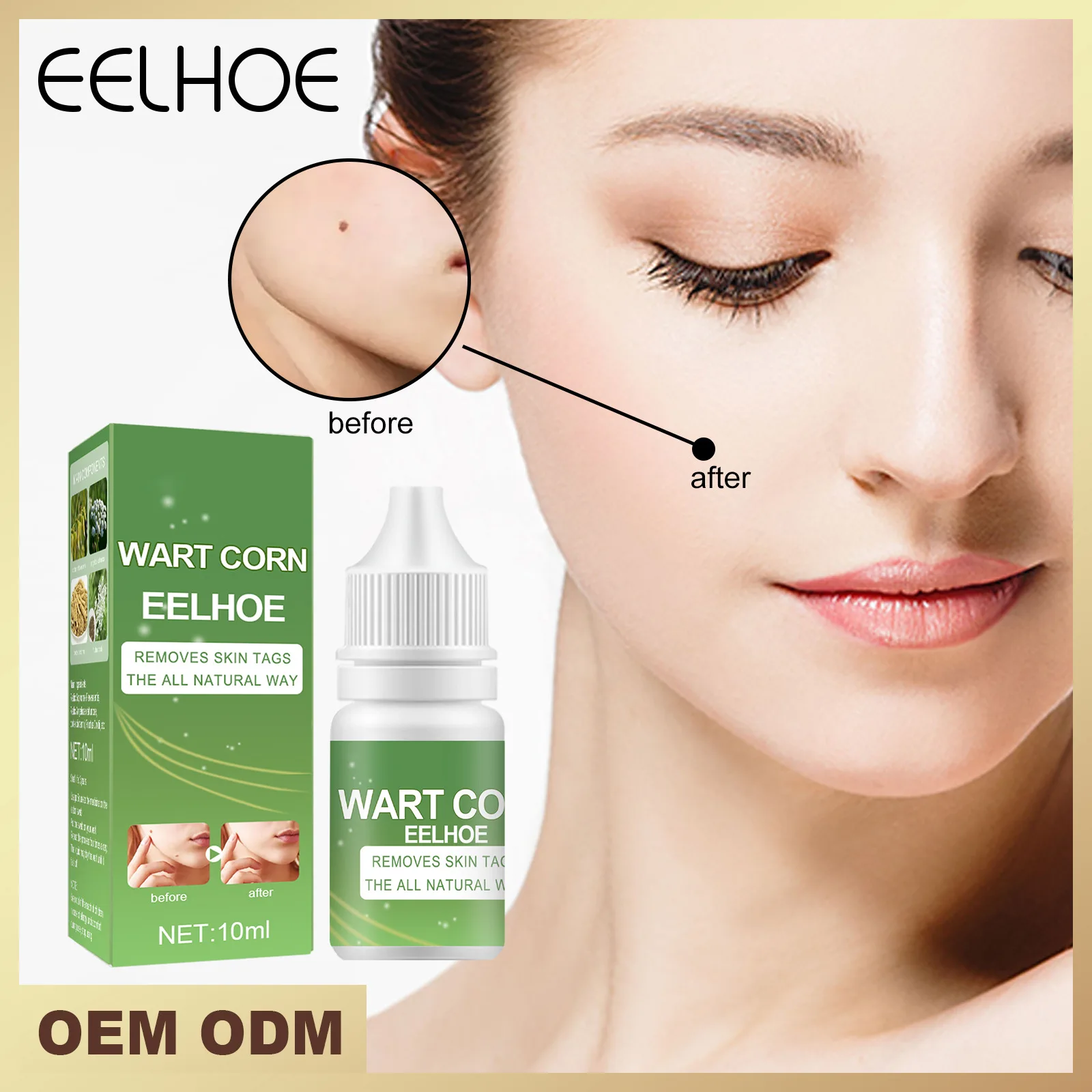 

Eelhoe Anti Nevus Potion Dispels Black Spots On The Skin, Lightens Melanin, and Removes Black Spots On The Face,without Scars