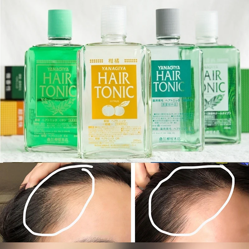 

240ml Hair Growth Liquid Hair Root Nutrient Liquid Make Hair Thicker Nourishing Essential Oil and Prevent Deoiling