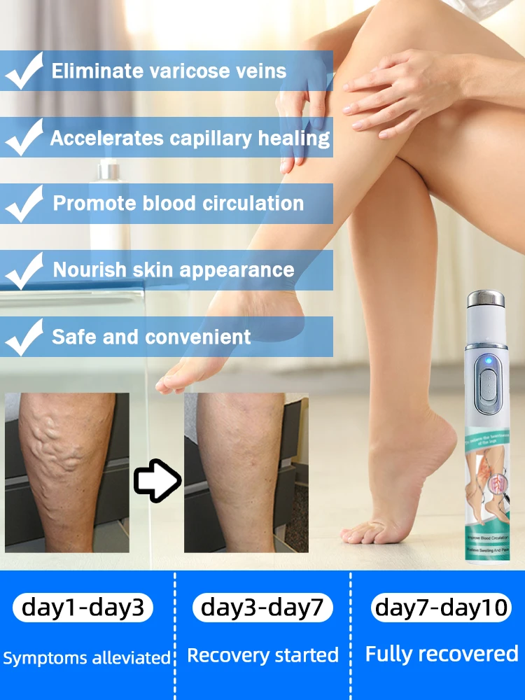 Лидер продаж лазерная жила