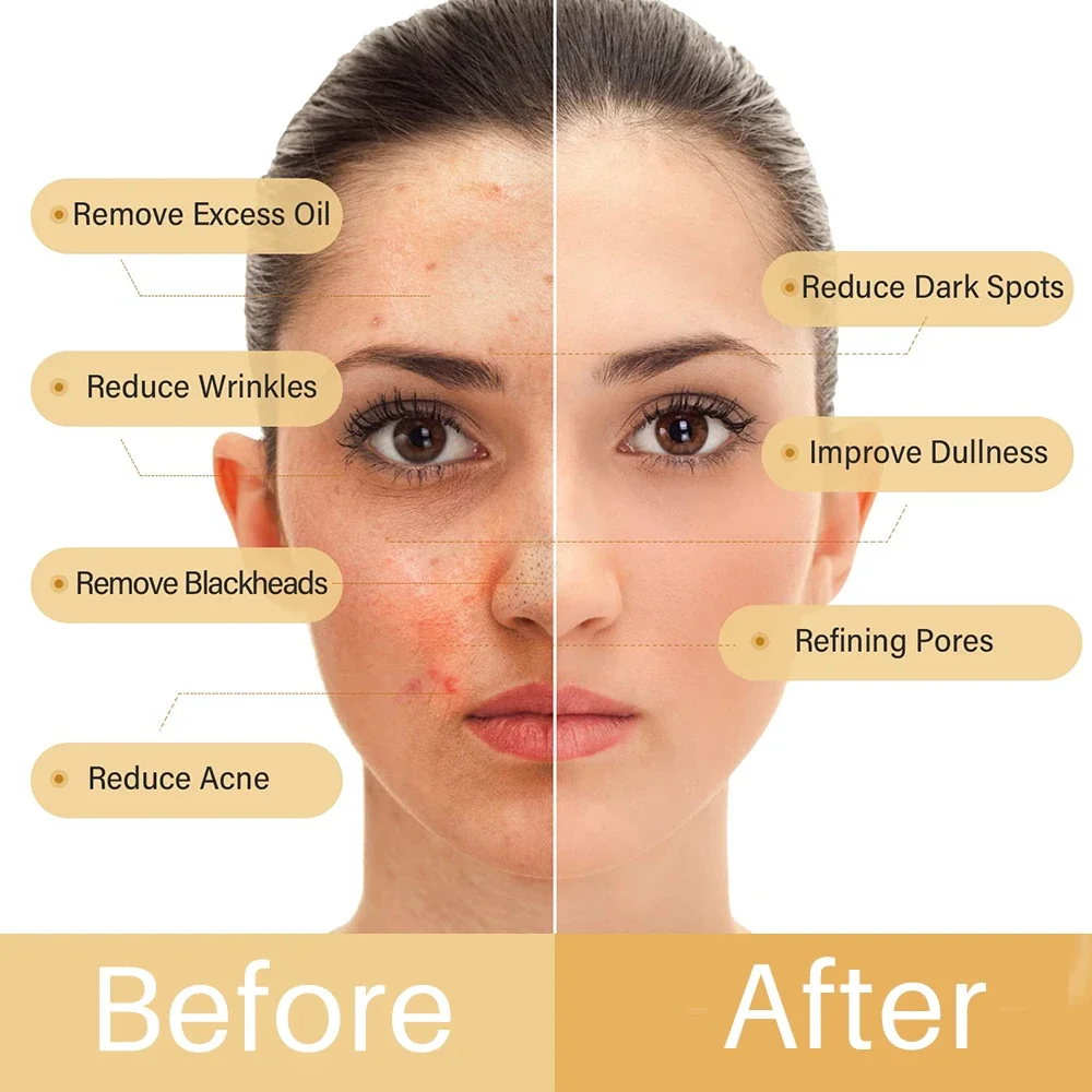 Увлажняющее средство для лица с куркумой контроль жирности Глубокая очистка