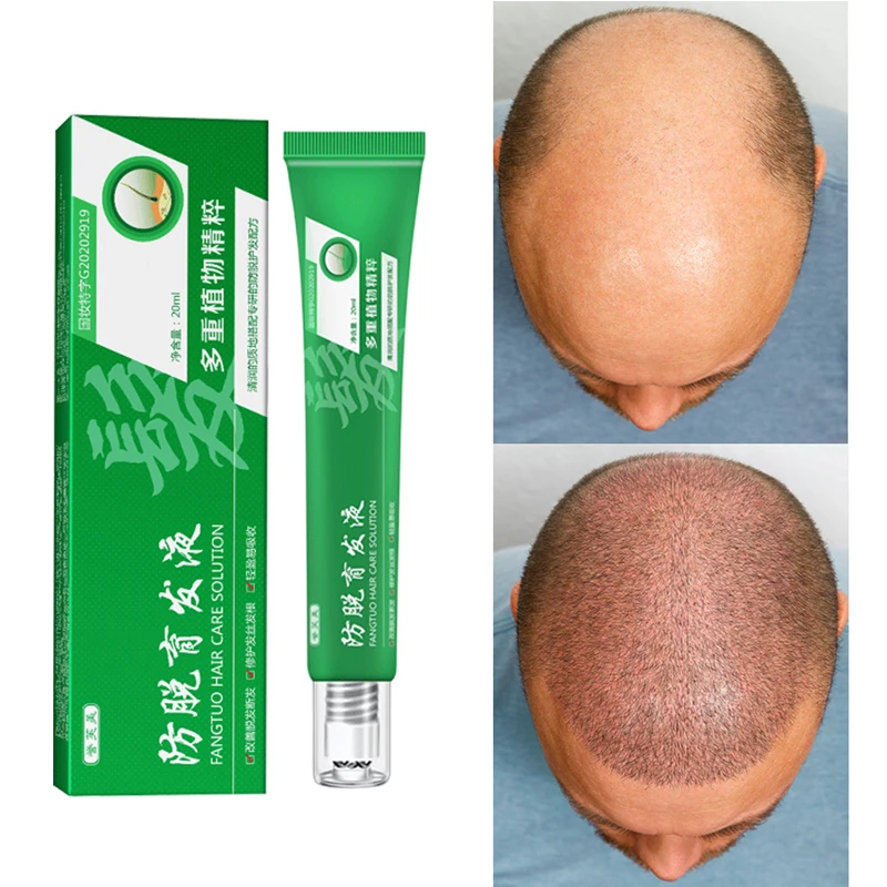 2023 Fast Hair Growth Serum For Women Men Beard Growth Baldness Hair Loss Treatment Biotin For Hair Regrowth Oil Products 20ml