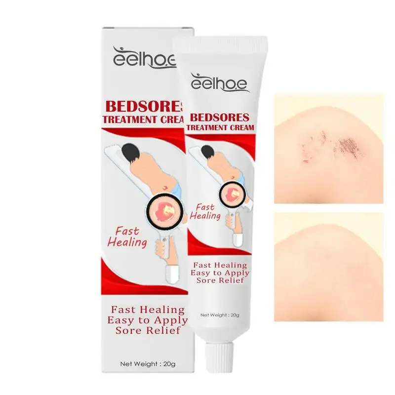 

Крем Bedsoress для пожилых людей 20 г мазь для сна крем для ухода за кроватью крем для быстрого заживления ран успокаивающий рельефный крем