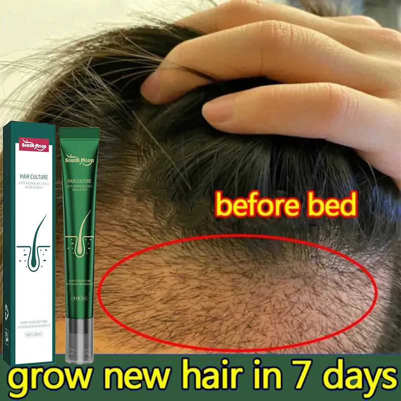 

Мощная Сыворотка для роста волос, быстрая против выпадения волос, продукт для роста волос, восстанавливающий питательный восстанавливающий рост корней волос для мужчин и женщин, красота, здоровье