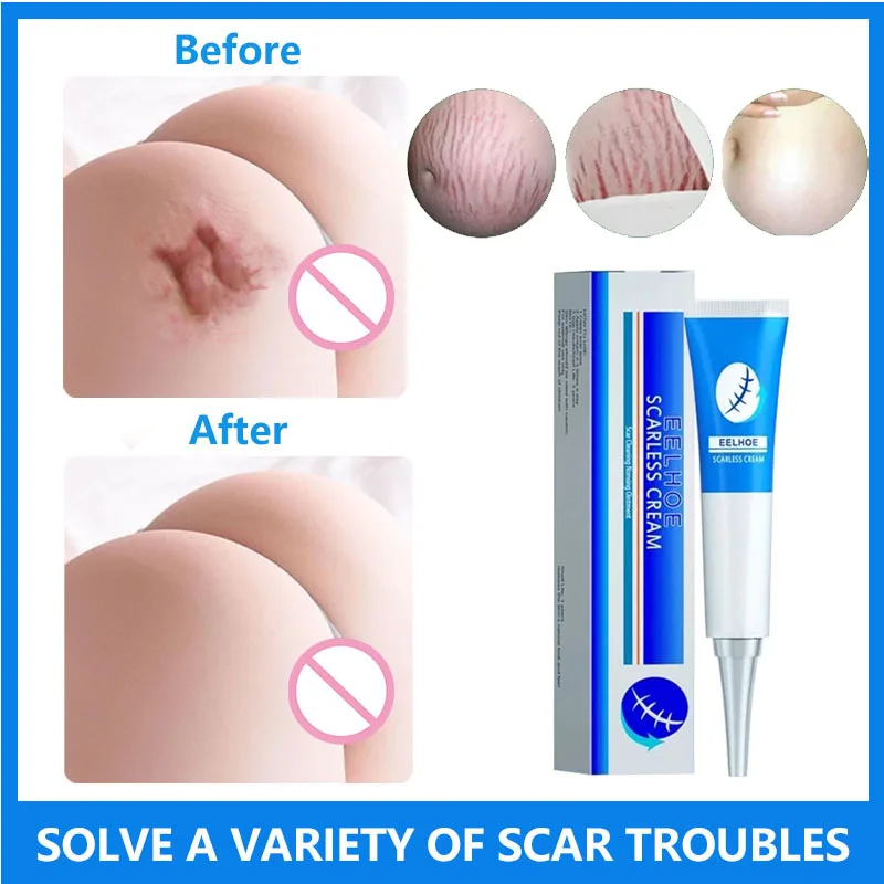 

Scar Cream Gel Effective Repair Surgical Scars Stretch Marks Acne Pits Pockmarks Burn Scars Repair Treatment Whitening Skin