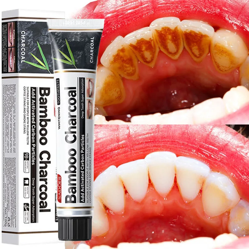 

Teeth Whitening Toothpaste Deep Cleansing Oral Hygiene Protect Gums Remove Bad Breath Plaque Stains Teeth Brightening Care 100G