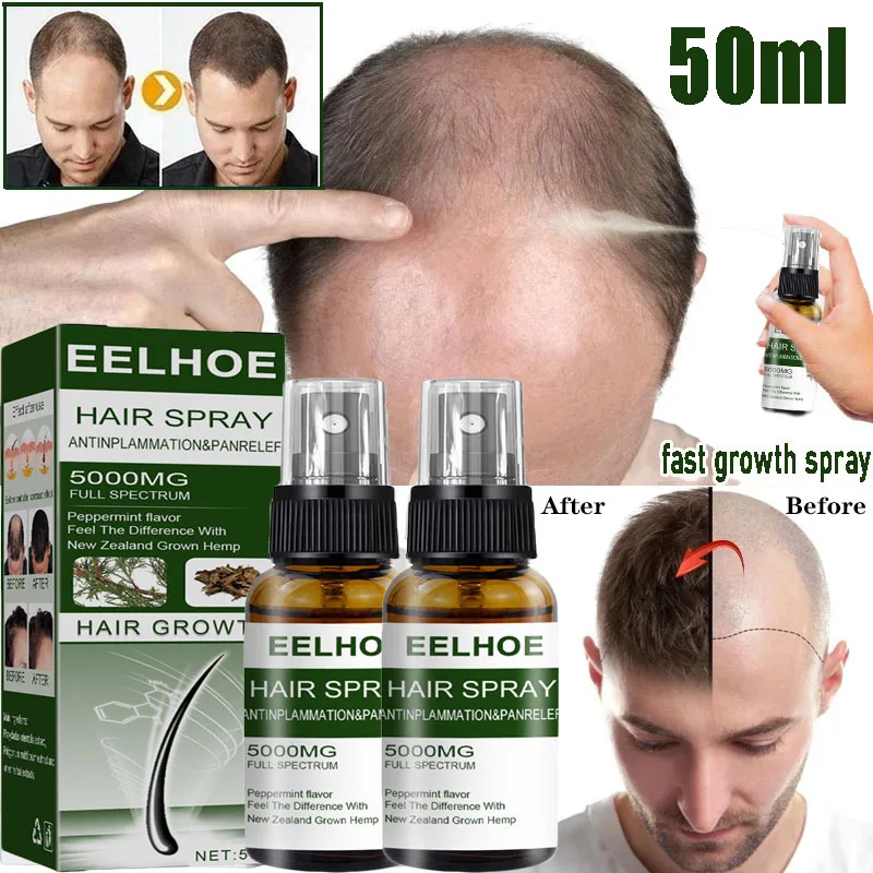 

Hair Growth Serum Spray Fast Hair Growth Liquid Treatment Scalp Hair Follicle Anti Hair Loss Natural Beauty Health Hair Care
