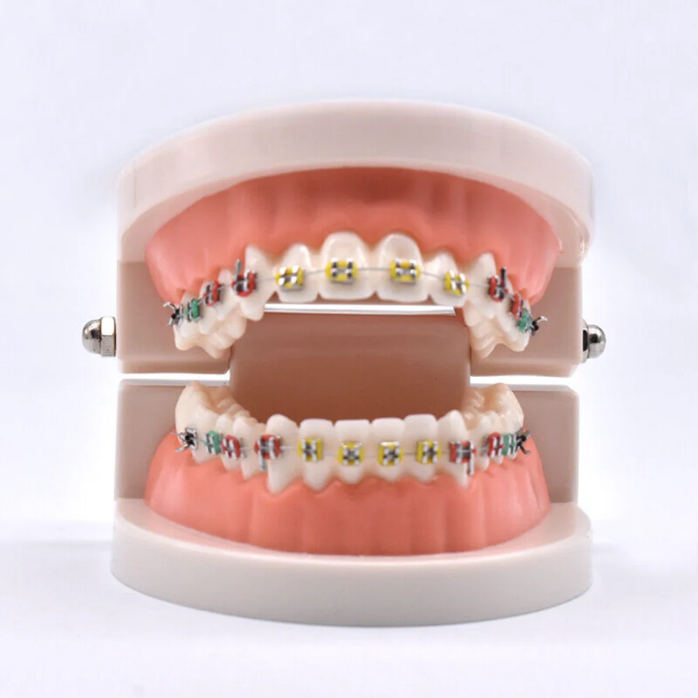 Dental Orthodontic Teeth Model with Metal Bracket Tubes for Dentisit Study Demonstratio