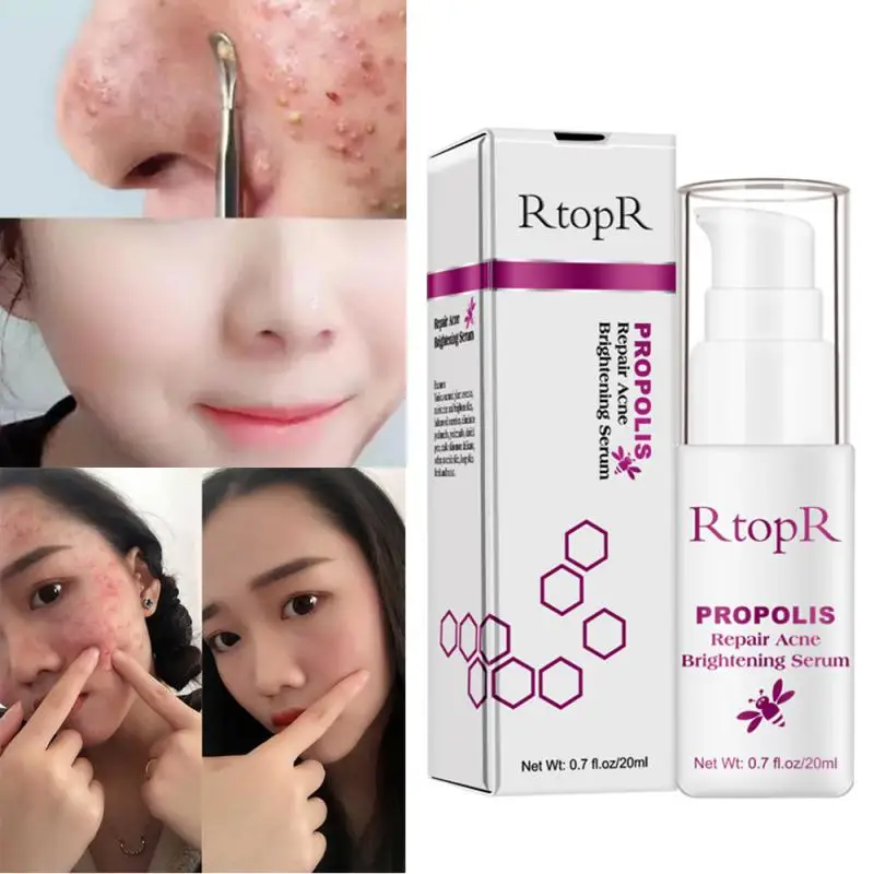 

1PCS Face Serum Propolis Acne Removal Hydrating Nourish Lighten Facial Skin Essence Firming Skin Shrink Pores Cosmetics Makeup